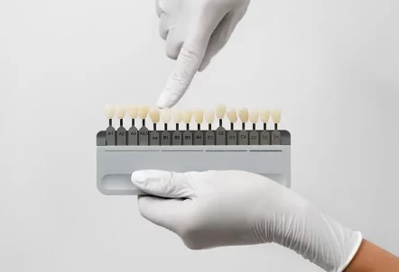 Five Common Misconceptions About Porcelain Dental Veneers